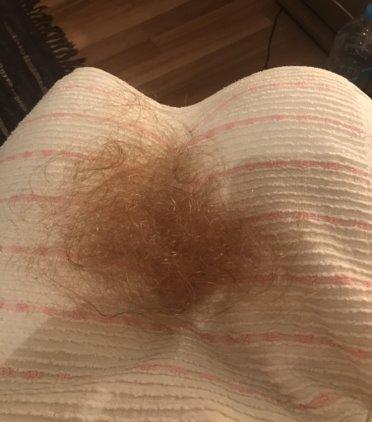 Hair that has fallen out resting on a white and pink striped square.